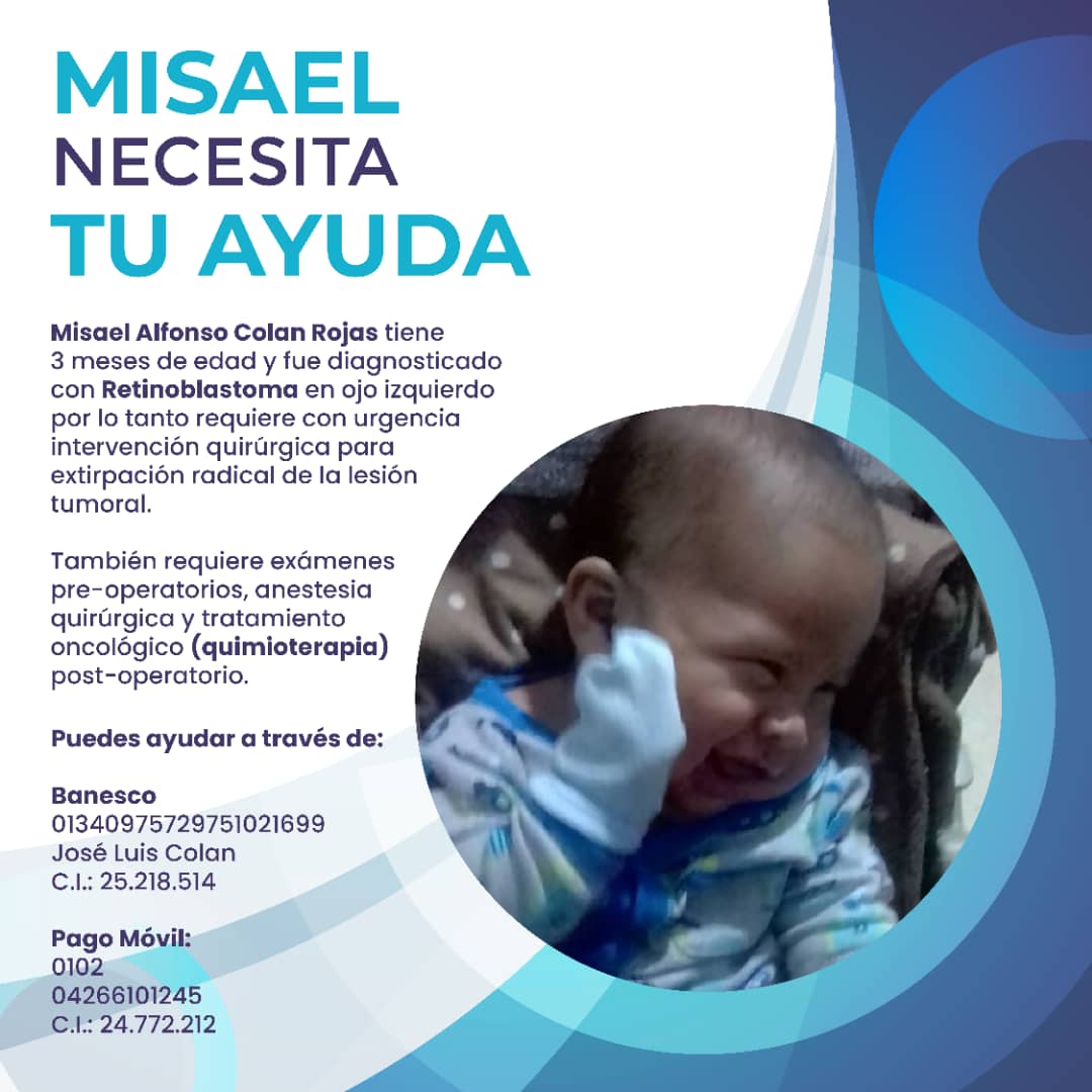 #ServicioPúblico | Misael Colan tiene 3 meses de nacido, y fue diagnosticado con retinoblastoma en el ojito izquierdo, por lo que requiere de una intervención quirúrgica para extraer su ojito y colocar un implante.

¡Demos una mano amiga!
Contacto: 0426-610.12.45

#Yaracuy