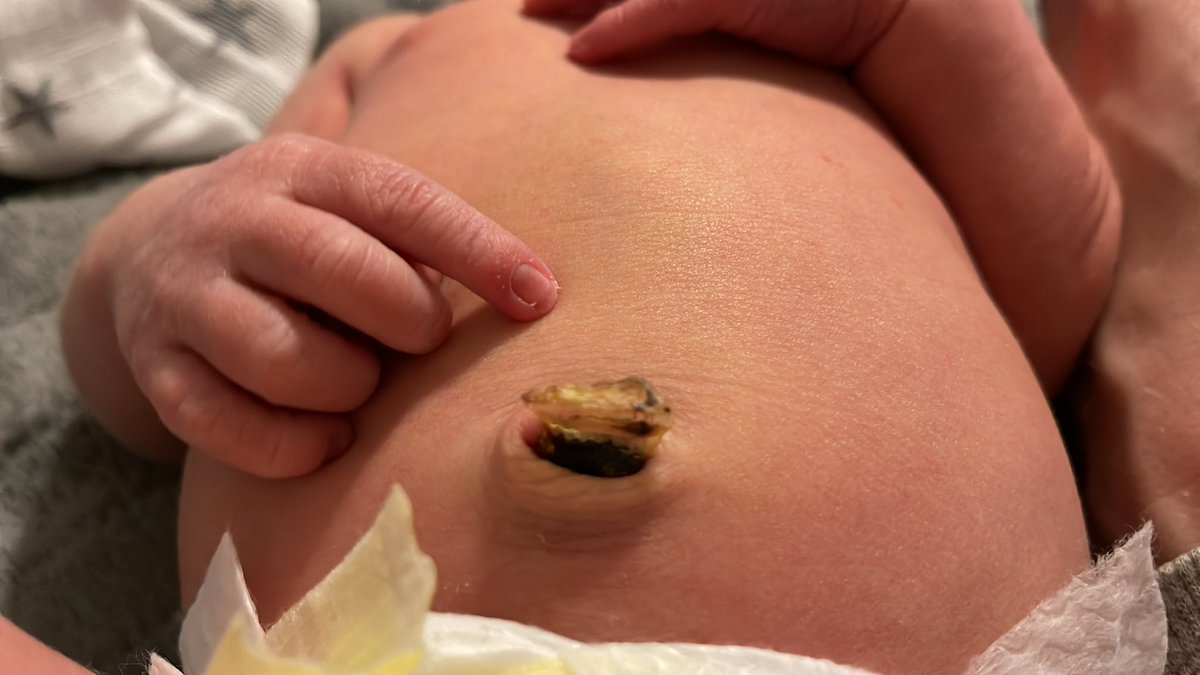 My son’s crunchy bellybutton looks like some tiny teriyaki beef jerky (@JackLinks)