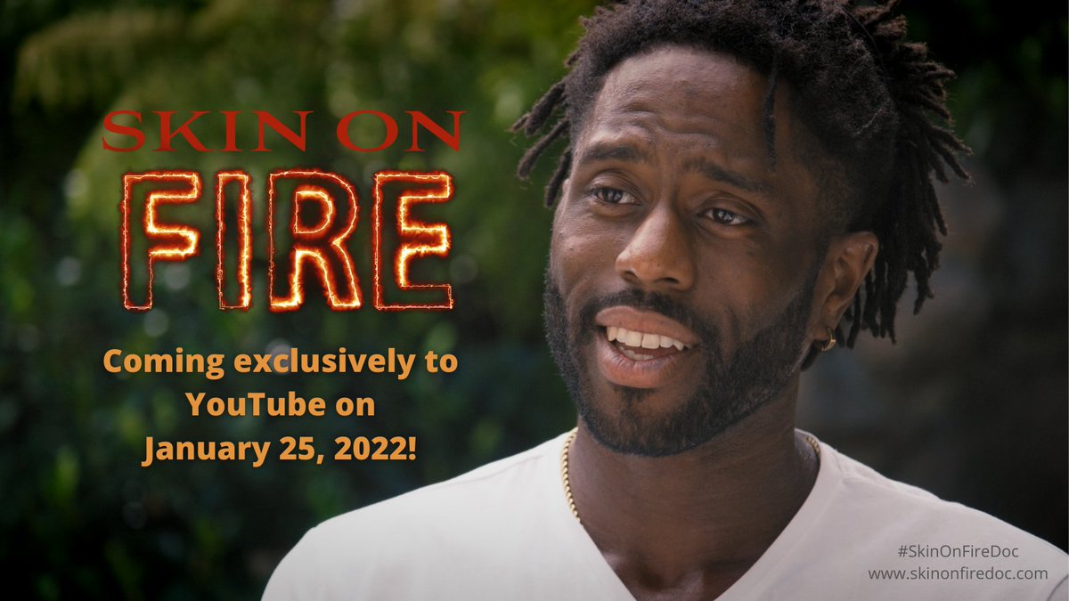 ITSANnonprofit's tweet photo. In the new film #SkinOnFireDoc, coming to YouTube on Tues. 1/25, learn about Topical Steroid Withdrawal (#tsw), how it has impacted the lives of individuals of all ages, backgrounds, & walks of life, and how it may be prevented & treated. https://t.co/8qjJxC53kn
@PCHFilms https://t.co/Se6Nfhuavk