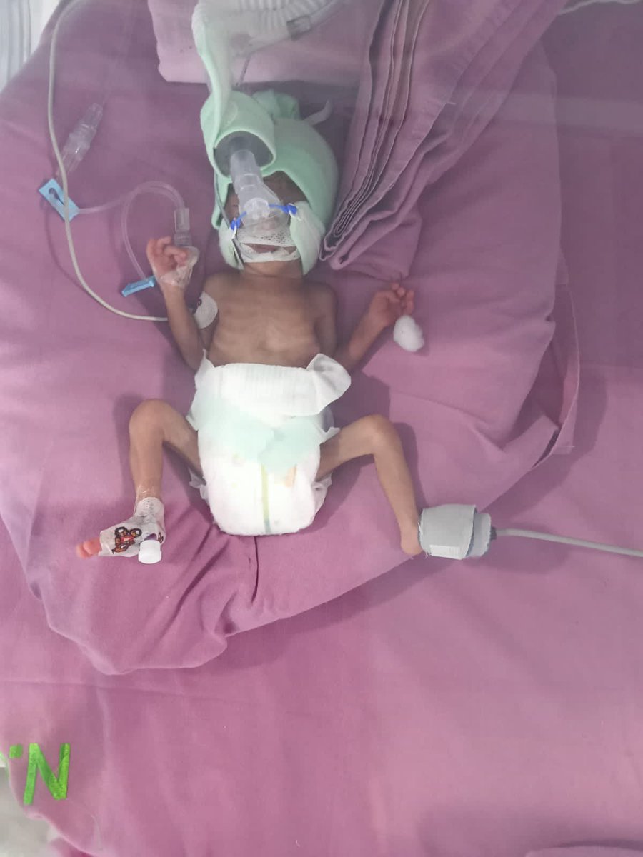 tirthaniakash07's tweet photo. @SoodFoundation sir need your help mere relative ko premature baby peda hue h wo apna sab kch lga chuke h i rqst pls help him unko 2baby girl hui h jo neo clinic nirman nagar mein hai mai apko unke pita ji ka no bhj rha hu  8952891261 (nitin ji )🙏🏻🙏🏻🙏🏻🙏🏻 hope you will help him https://t.co/K31zYcj6ne
