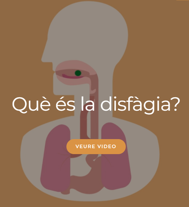 T'expliquem què és la disfàgia, a què s'hi associa i els seus tractaments. 

Per veure el vídeo complet fes clic aquí: furega.com

#disfàgia #video #furega #tragabien #salut