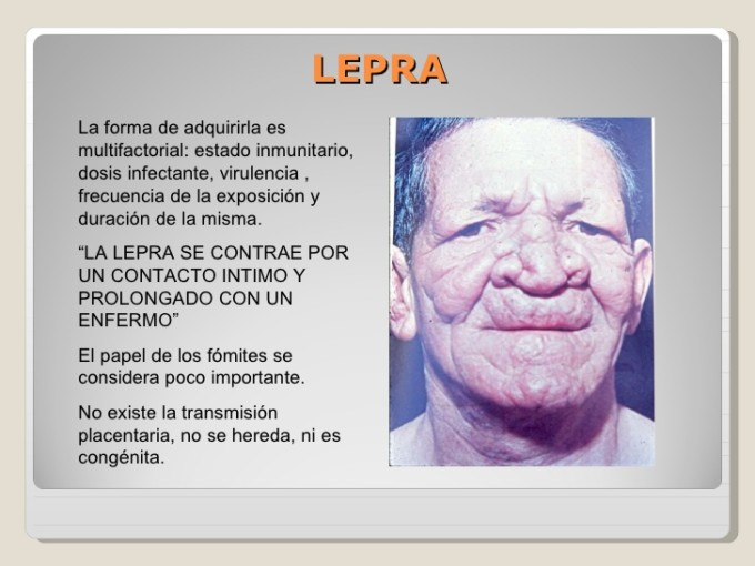 NMABarinas's tweet photo. #21Ener La Lepra  La enfermedad afecta principalmente a la piel, los nervios periféricos, la mucosa de las vías respiratorias superiores y los ojos.
#DigesaludFANBCuidaTuSalud https://t.co/tJVbolvhCS