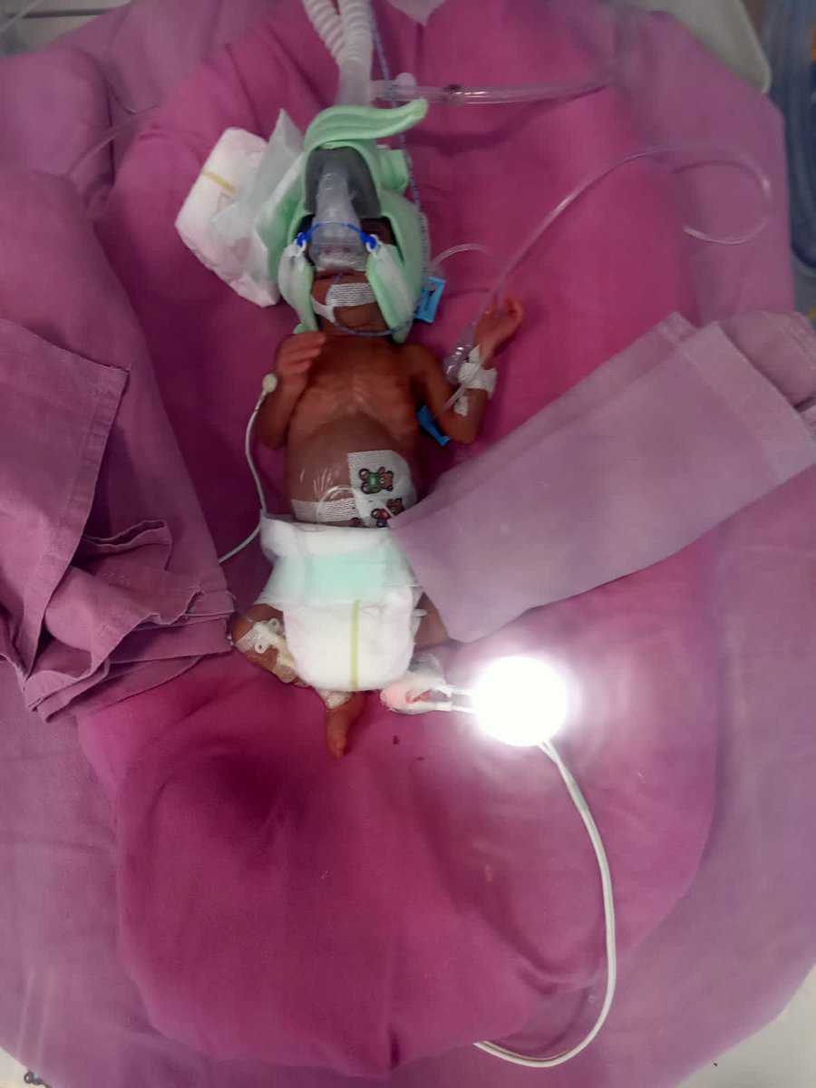 tirthaniakash07's tweet photo. @SonuSood @FcSonuSood need your help in urgent sir 🙏🏻 mere realtive me do premature baby girl hue h jo ki neo clinic hosital jaipur mein hain inke pita apna sab kch laga chuke h ab wo asamrth hai so please help him sir 🙏🏻m apko unka no bhj rha hu 8952891261 nitin sharing u images https://t.co/PEOK05GbJu