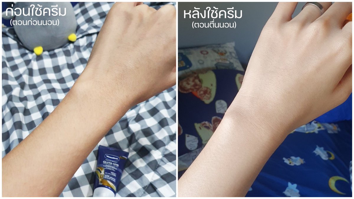 memayerr's tweet image. ดูแลผิวหน้าแล้วผิวตัวก็ห้ามลืมเด้อ! นี่ลองโลชั่น #วาสลีนกลูต้าไฮยา สูตรกลางคืนมาสักพักละ ทาทุกคืนก่อนนอน จากผิวโทรมๆ ดูกระจ่างใสขึ้น อิ่มฟูขึ้น จริงๆ เนื้อบางเบา ไม่เหนอะ แถมทาละนอนได้เลย อยากให้ลองจริงๆ ตอนนี้มีโปร 1แถม1 ที่ 7-11 ด้วย ไปจัด! #Haveaglownight #นอนหลับผิวดี