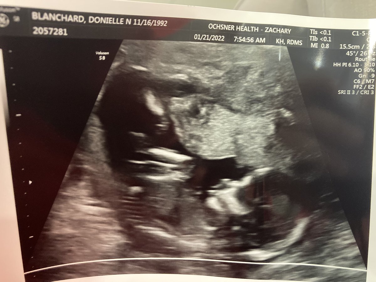 DonnieDarque's tweet photo. It’s a boy!!! And he looks like he has his daddy’s head and nose 🖤 https://t.co/ApOnEsIp0S