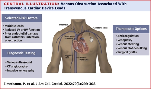 EricSecemskyMD's tweet photo. This topic does not get enough attention, but is a prevalent issue, especially with the growth of implanted cardiac device leads. Fantastic collaborative work led by @ZimetbaumP & including @andrewlocke08 #BrettCarroll @MarcScherm @BidmcCvi @SmithBIDMC
https://t.co/2McIr5uY4a https://t.co/QviQyOr4gX