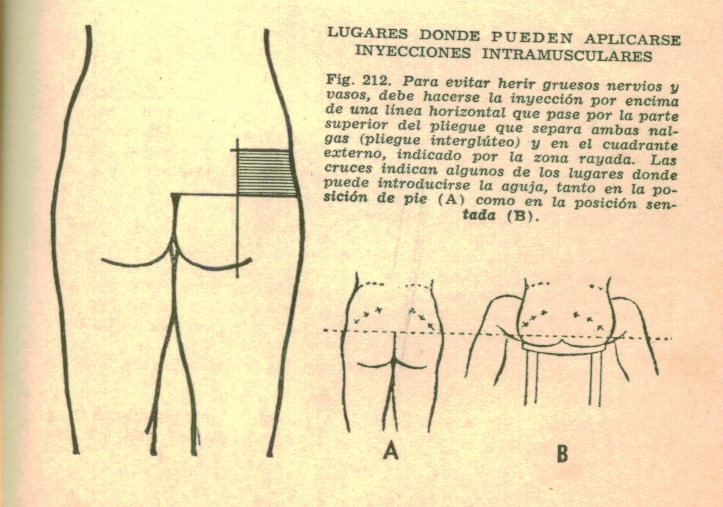 CirujanoGZ's tweet photo. Es fácil inyectar 💉, cuadrante SUPERIOR y EXTERNO de la nalga (les pongo dibujo, no foto para q no me censuren 🙄). Recuerde: si es IM intramuscular:
1 Es profundo (toda la aguja)
2 Aspire antes de inyectar para corroborar que no está en un vaso sanguíneo
3 Sea gentil pero firme https://t.co/SJU0xeKBMv