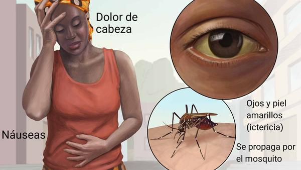 NMABarinas's tweet photo. #21Ener Si tienes fiebre amarilla, el virus se puede detectar en la sangre. Sin embargo, si no se detecta, en el análisis de sangre también se pueden encontrar anticuerpos y otras sustancias específicas relacionadas con el virus.
#DigesaludFANBCuidaTuSalud. https://t.co/sq1MZ378wZ