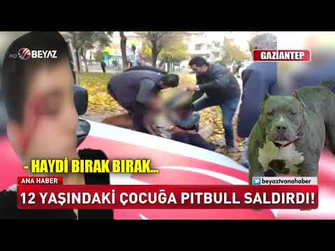 Sahiplerinin bile kontrol edemediği bu hayvanlarla çocuklarının, sevdiklerinin aynı sosyal ve kamusal ortamları paylaşmasını istiyor musun gerçekten? #KöpekTehlikesi
