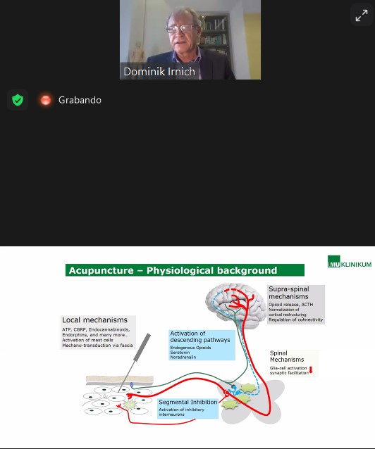 El Dr. Dominik Irnich, Jefe de Sección del Servicio de Anestesia y Presidente de la Asociación de Acupuntura Médica de Alemania, refiere que "la #acupuntura puede ayudar a la reestructuración cortical por lo que es útil para tratar el #dolor" #VIISimposioSAME