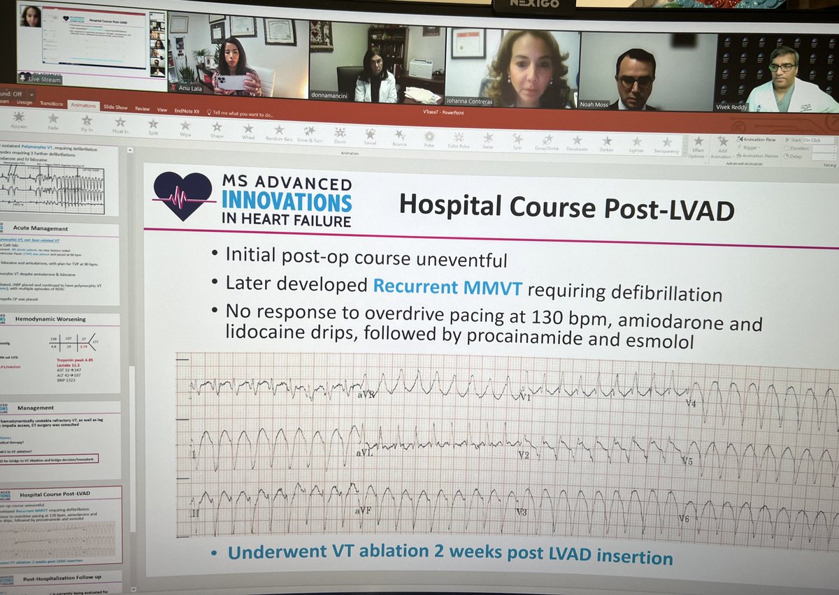 #EPeeps ! Working with #FunctionNotFailure to determine management of arrhythmias in heart failure! Happening now!⏰
@VivekReddyMD Marc Miller @NoahMossMD & Srini Dukkipatti! This is @MSadvancedheart !! @Jcontreras75