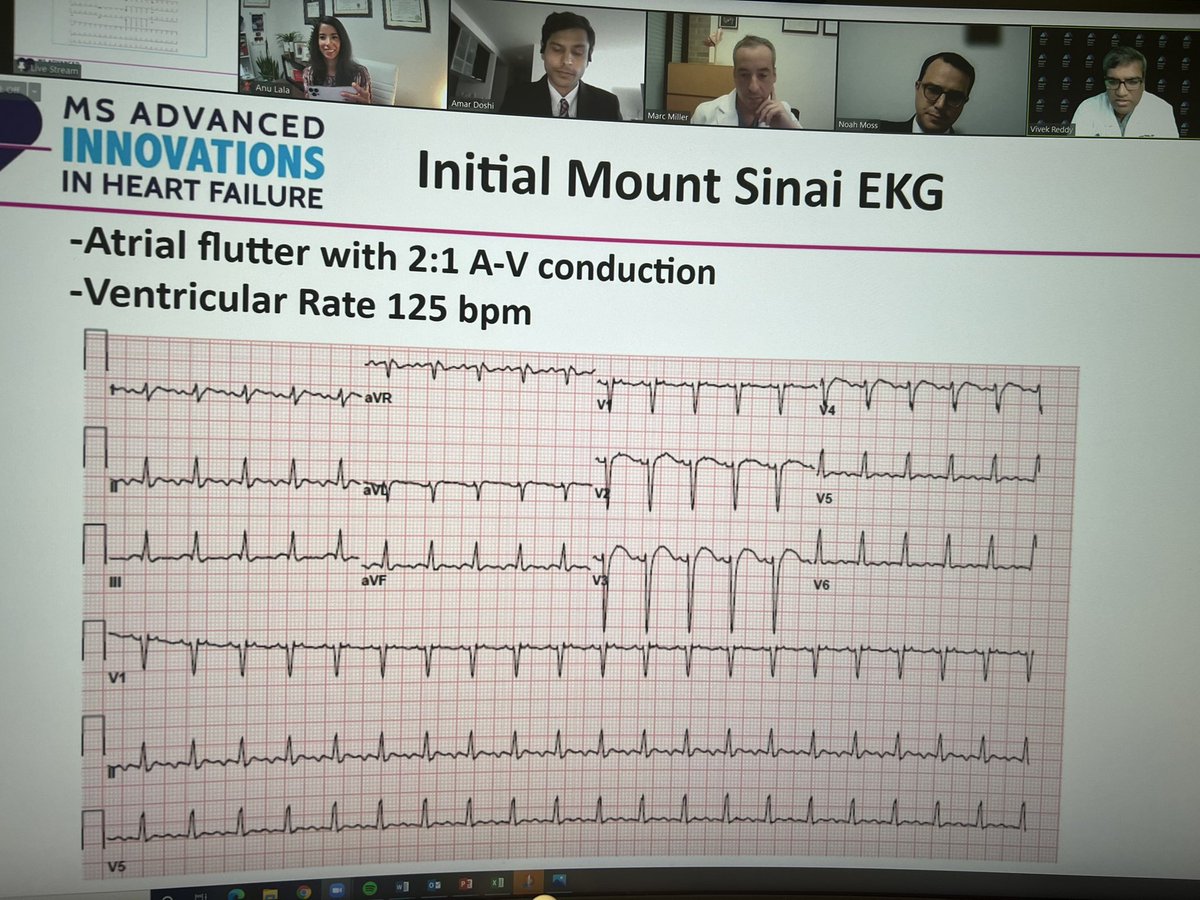 dranulala's tweet photo. #EPeeps ! Working with #FunctionNotFailure to determine management of arrhythmias in heart failure! Happening now!⏰
@VivekReddyMD Marc Miller @NoahMossMD &amp; Srini Dukkipatti! This is @MSadvancedheart !! @Jcontreras75 https://t.co/vHfysiv1TJ