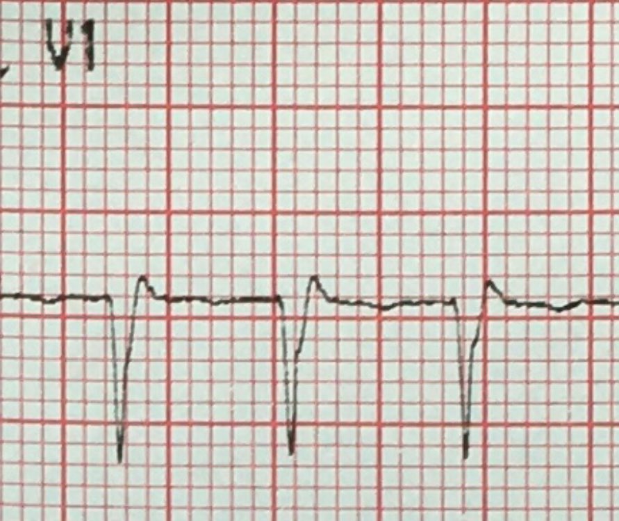 EfectoElectrotónico tweet media