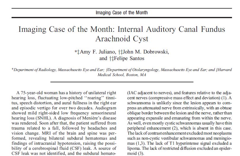 amyfjuliano's tweet photo. A rare, or possibly rarely described, entity not to forget when an MR seems 'negative' for SNHL, esp if there's history of trauma. Follow CN VIII in the IAC on hT2W seq, see if there might be a focal deviation that might just be a tiny IAC arachnoid cyst!
https://t.co/c9nmGhM0gf https://t.co/spXSQo00ts
