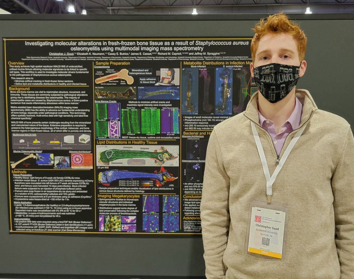 Caprioli Lab (@capriolilab) on Twitter photo Congratulations to our newest PhD Candidate Chris for passing his qualifying exam this week!
<a href="/CaprioliLab/">Caprioli Lab</a> | <a href="/SpragginsLab/">Spraggins Lab</a> Congratulations to our newest PhD Candidate Chris for passing his qualifying exam this week!
<a href="/CaprioliLab/">Caprioli Lab</a> | <a href="/SpragginsLab/">Spraggins Lab</a>
