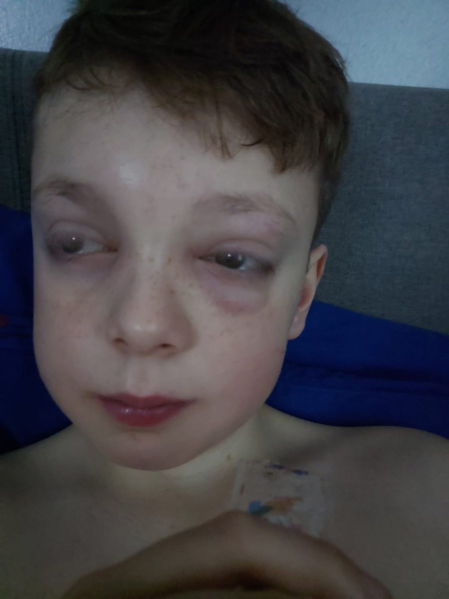 Angela83w's tweet photo. @stannesrcp @garyfr3 Thank you to the school for understanding &amp; supporting us &amp; Ryan through his illness! Hes been so poorly over xmas &amp; St Annes are the best school ive known! Offering their help &amp; support to get ryan back to normality.. I'll be sad when he leaves this year. ❤ https://t.co/9mkEsexyV4