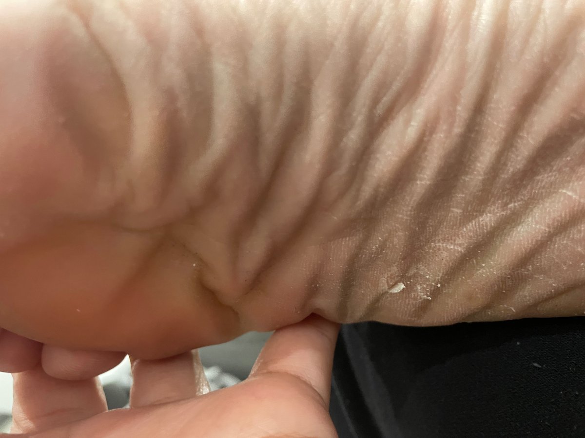 justokayfetz's tweet photo. Crusty feet! I need a pedicure 😩 #Feetoken #fetish #feetworshipping #feetlady #feelings https://t.co/B4YlapOJLc