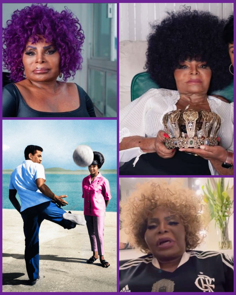 Cema_phoenix23's tweet photo. R.I.P. Rainha Elza Soares! 💔✨👑🌹😢
Eterna em nossos corações! 💞🙏🏼
🎶 Ali onde eu chorei
Qualquer um chorava
Dar a volta por cima que eu dei
Quero ver quem dava
https://t.co/7kyRFAqUTF
#ElzaSoares #ElzaEterna #RIPElza
#VoltaPorCima #ElzaSoaresEterna
#ElzaSoaresPresente! ✊🏾 https://t.co/UI8YK6qsCd