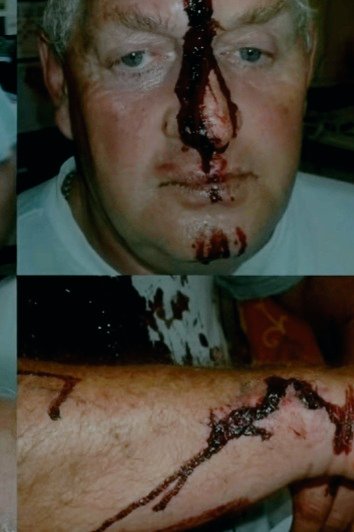 PaulPaulus13's tweet photo. 🇿🇼Karoi Police confirmed "receiving report"#Mliswa beat up Jenny Parsons& her2children@Spring Farm they returned2their farm2 feed horses&collect personal belongings when confronted by #Mliswa,who stated @LanceGuma "I never beat up anyone, farmers are my friends"😲
#TembasVictims https://t.co/f04H24UfmQ
