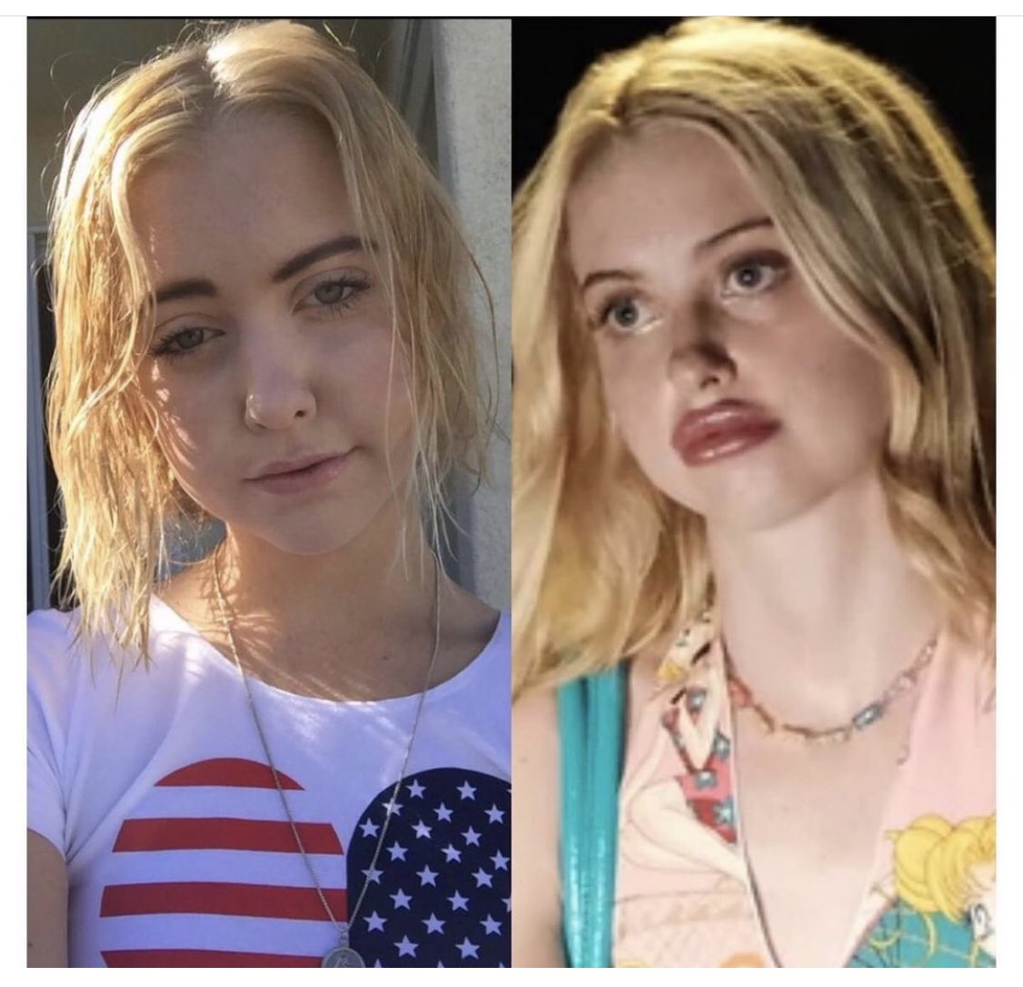 The Cosmetic Lane on X: Euphoria's Chloe Cherry is now being called the  Lip Girl online & we see why... How does this happen? Overfilling lips way  too quickly! When you don't