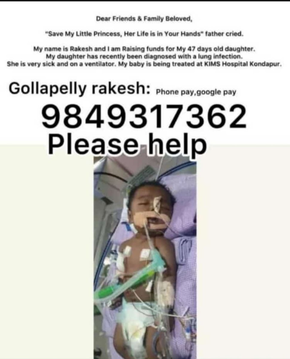 chintu4494's tweet photo. My Friend daughter has recently been diagnosed with a lung infection. She is very sick and on a ventilator. My baby is being treated at KIMS Hospital Kondapur. Kindly help this Baby Sir/Madam🙏🙏 @KTRTRS @KTRoffice @RaoKavitha https://t.co/au4u9tAf1b