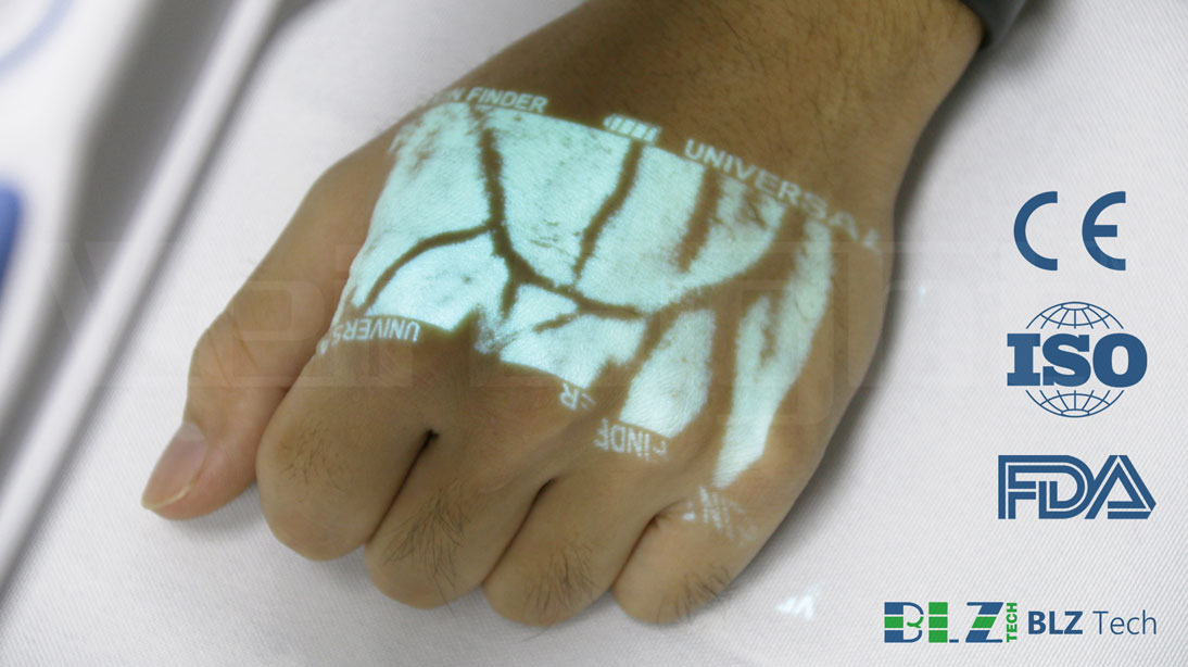 FinderVein's tweet photo. Wearing gloves and mask, nurses may find it difficult to perform venipuncture. 
#Veinfinder will be a real good helper in this #COVID situation. 
Learn More: https://t.co/6pMonkPoWX
#medicaldevice https://t.co/6IajkxkADi