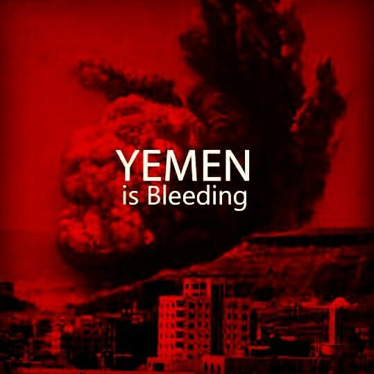 Huma030's tweet photo. Ya Allah #YemenUnderAttack 
Please make it a trend 😭 https://t.co/DrHivraijO