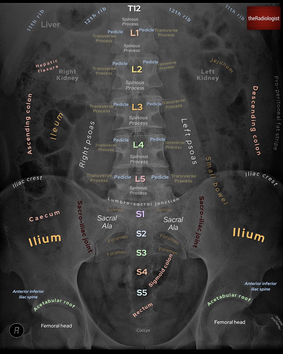 Abdominal X-Ray anatomy