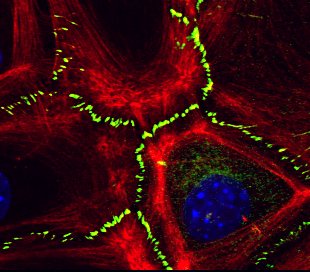 MicrocosmicNFT's tweet photo. Just found one of the very first laser microscope images we took. who knows what is displayed? any cell biologists? Have a great day!
#Biology #NFTartist https://t.co/p8Rh4C7ueG