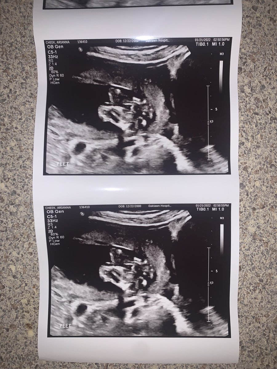antles_dylon24's tweet photo. Little update cause im never on here but our baby is growing so fast. The little pointy nose and the last one where shes waving to mom and dad are my favorite 😊 https://t.co/3s1lB0UFZQ