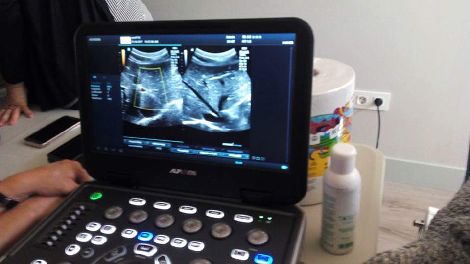 📢📢¿Quieres saber cómo obtener e interpretar imágenes como ésta? 👀 ¡¡¡No te lo puedes perder, inscríbete!!! 
👇👇
🔝🔝 Curso on-line de #Ecografia  #Hepatobiliar de <a href="/semfyc/">semFYC</a> #FormacionsemFYC #AtencionPrimaria #POCUS 
👇 
bit.ly/3qR78lT