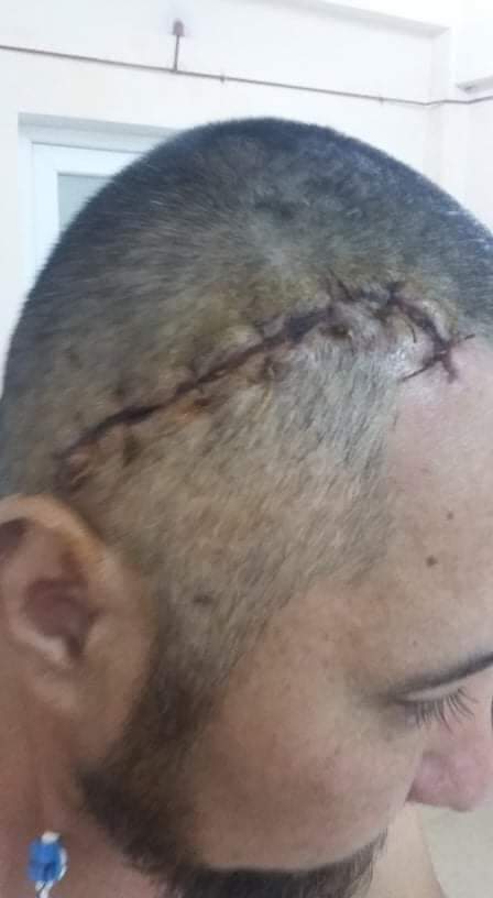 SimkaAktiv's tweet photo. HE'S ALIVE!
The man with the flag in #Almaty, carrying the flag of #Kazakhstan from under fire is Almaty activist Berik #Abishov. 
During his peaceful protest he was shot in the head and was in a coma all these days. He is awake now. Berik partially lost his memory. https://t.co/MO9VwbYUOA