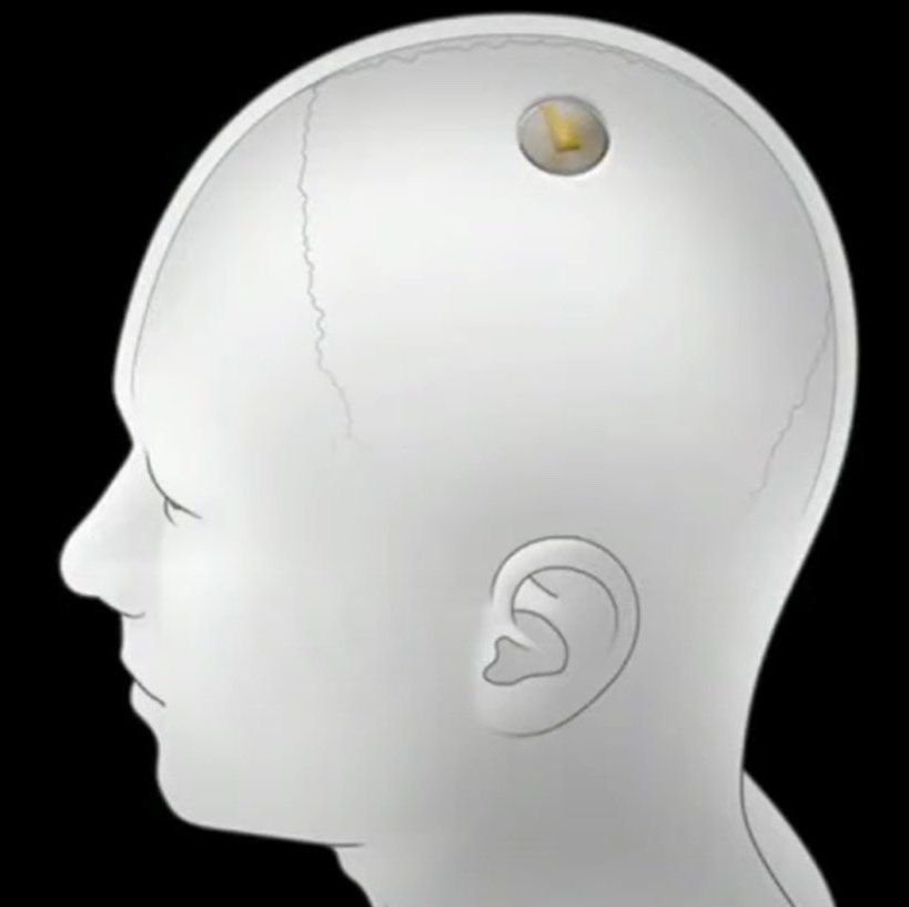 updatecultura's tweet photo. Neuralink, empresa de Elon Musk, irá iniciar esse ano o teste de chips cerebrais em humanos, que poderão salvar e reproduzir memórias, além de baixá-las em um novo corpo ou em um corpo de robô. https://t.co/CXko8W9PBM