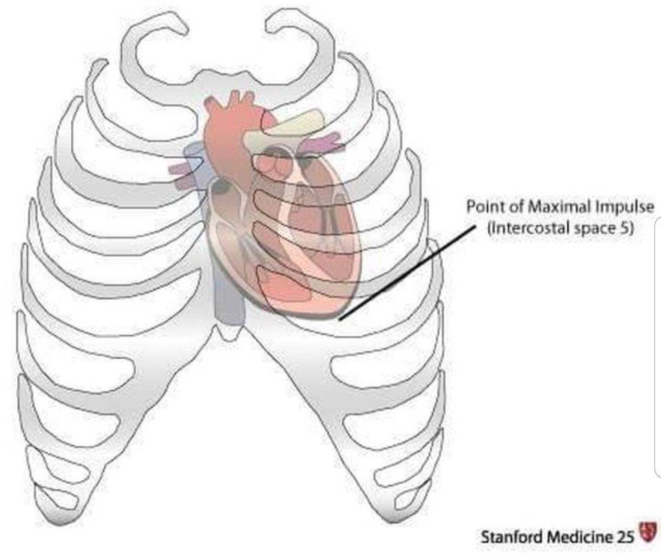 Midclavicular Line 5th Intercostal Space