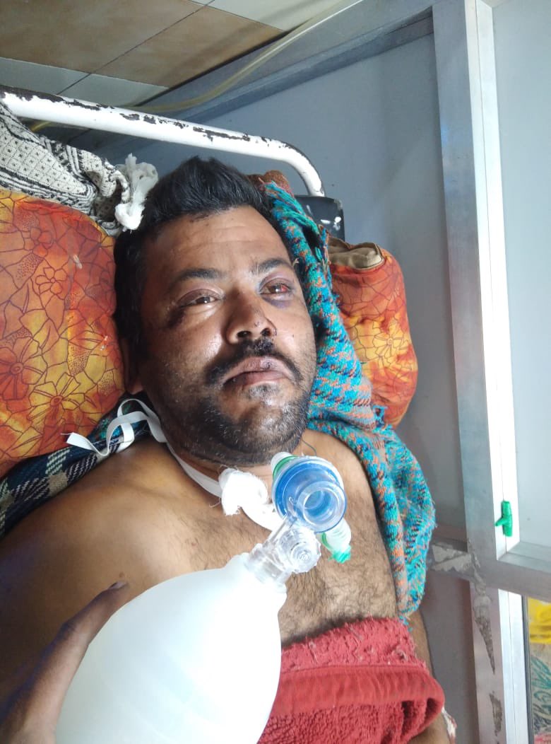 Abhinav Shukla tweet media