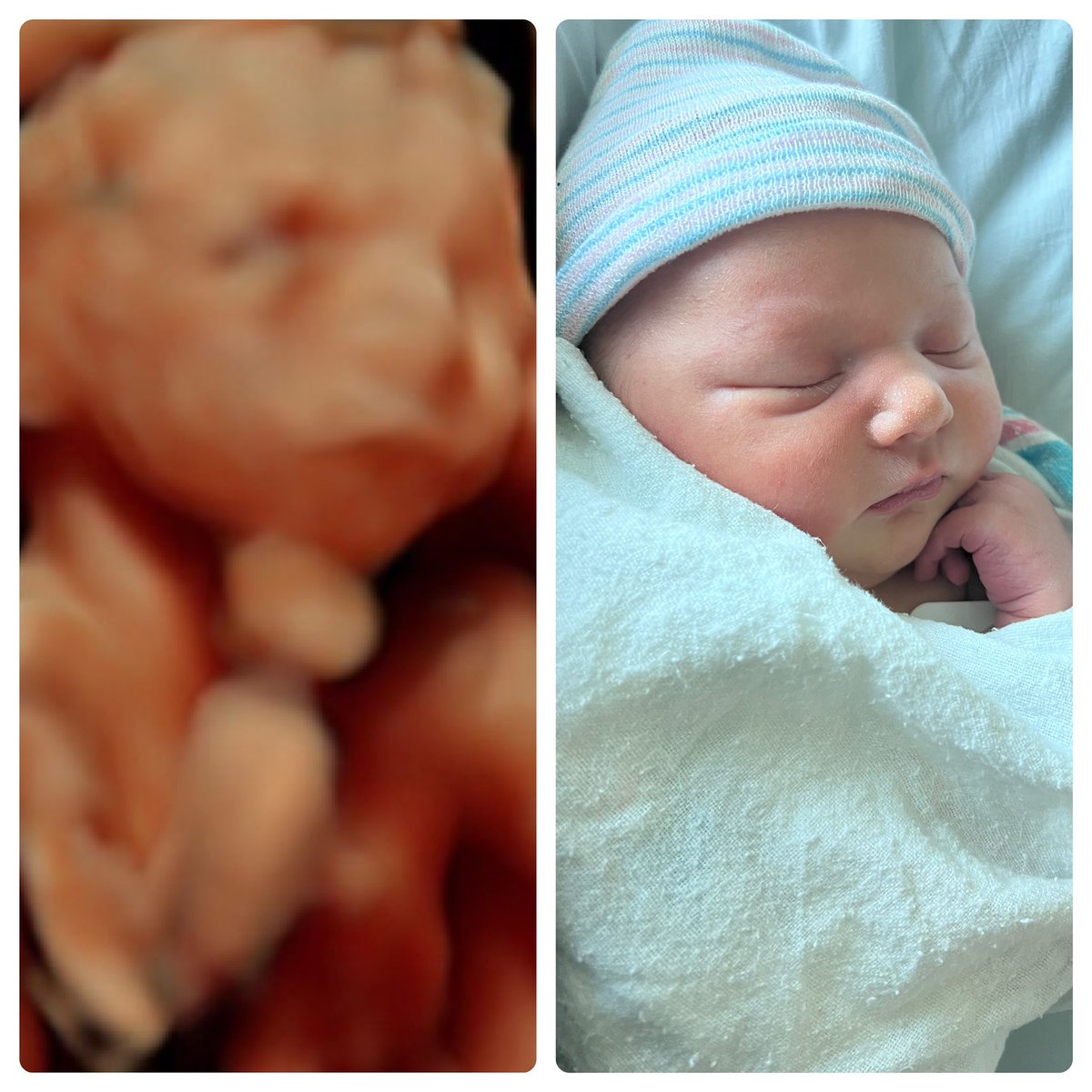 Shuckk_'s tweet photo. Once a thinking man, always a #ThinkingMan #newborn #SundayMorning #baby https://t.co/pnRXY1PhRl