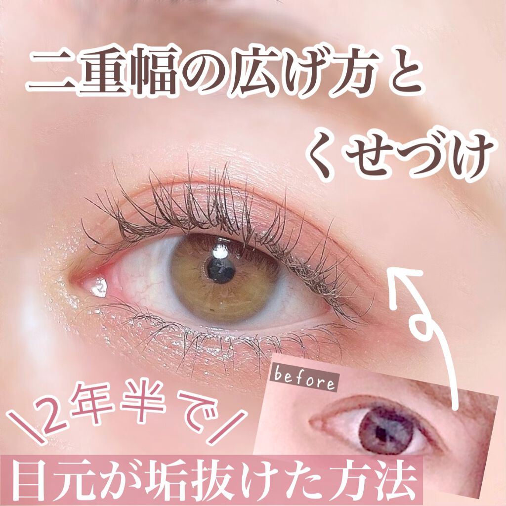 2年半で目元はここまで垢抜けられる！/私の二重幅の広げ方とくせづけ