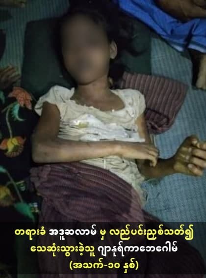 justice4arakan's tweet photo. ရခိုင်ပြည် မှုခင်းသတင်း ထုတ်ပြန်ချက် (၁/၂၀၂၂)
၂၀၂၂ ခုနှစ်၊ ဖေဖော်ဝါရီ (၇) ရက်

ရခိုင်ပြည်၊ ဘူးသီးတောင်မြို့နယ်၊ ဆင်သီပြင်(မူဆလင်)ကျေးရွာတွင် ဖြစ်ပွားခဲ့သော “လူသတ်မှု၊ လုယက်မှု”နှင့်ဆက်စပ်သည့်သတင်းအား ရက္ခိုင်ပြည်သူ့အာဏာပိုင်အဖွဲ့မှထုတ်ပြန်ခြင်း။ https://t.co/vXBRf6svbo