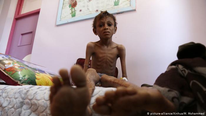 Anouar_____'s tweet photo. Ils ne s'appellent pas #Rayan mais ils ont besoin de vous aussi, 18 000 d'entre eux meurent chaque jours de faim, ne les oublions pas https://t.co/JqxX4iWiOd