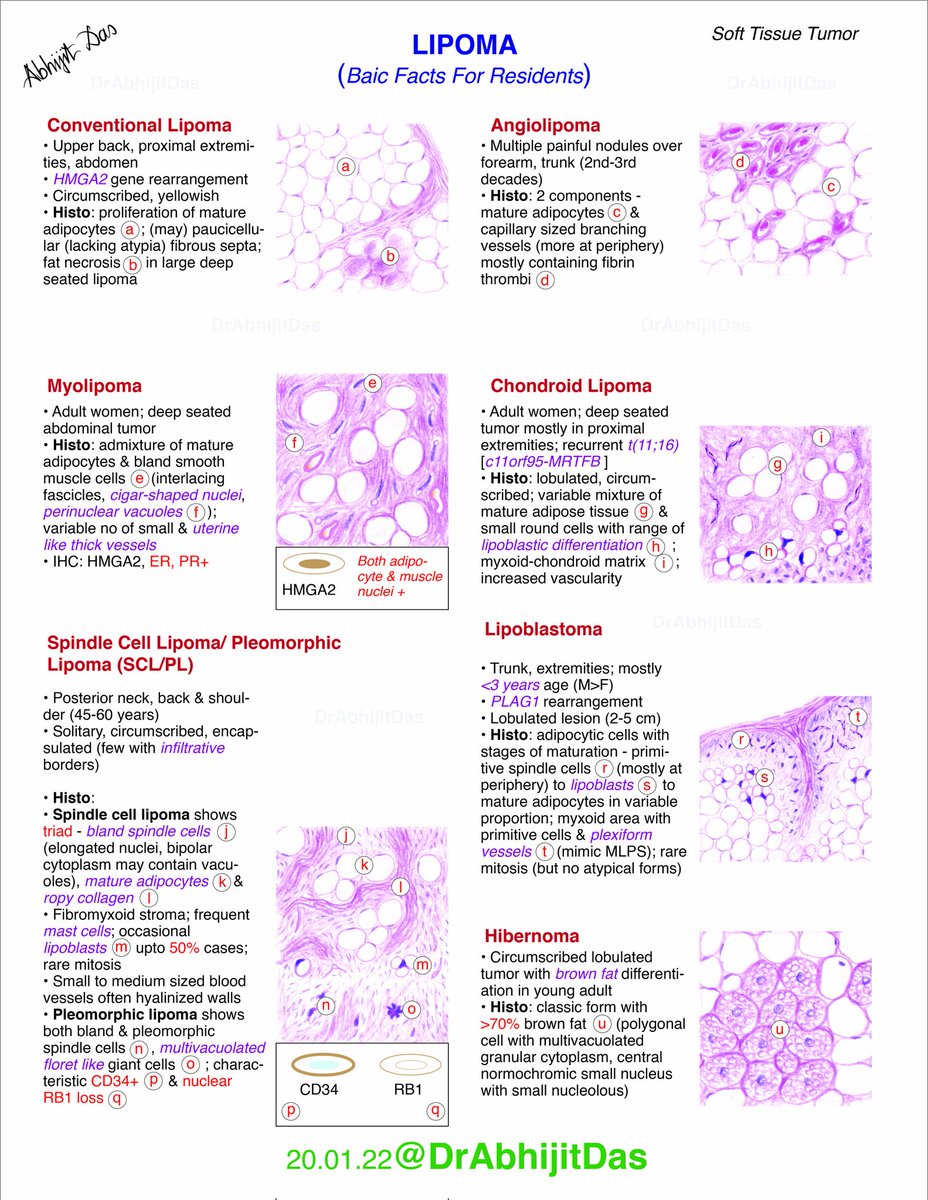 AbhijitSurgPath's tweet image. LIPOMA

Basic facts for residents. 

Important types, salient morphology and key notes...

#MakeSurgiPathEasy 
#Lipoma
#BasicFactsForResidents