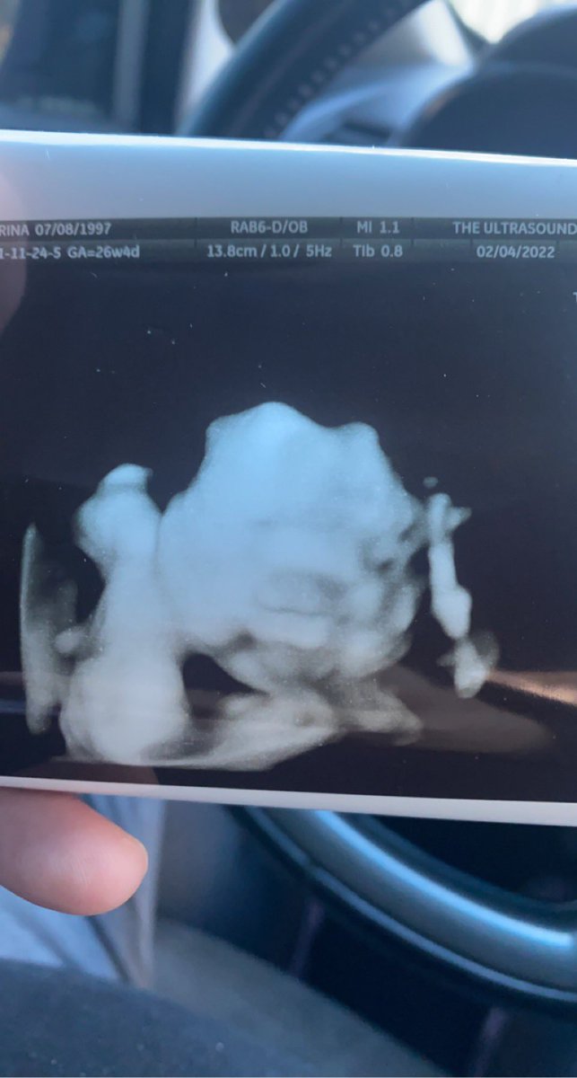 My 2nd blessing on the way in May 💙 Dada got you always mamas, I love you and your brother with all I got. 💙