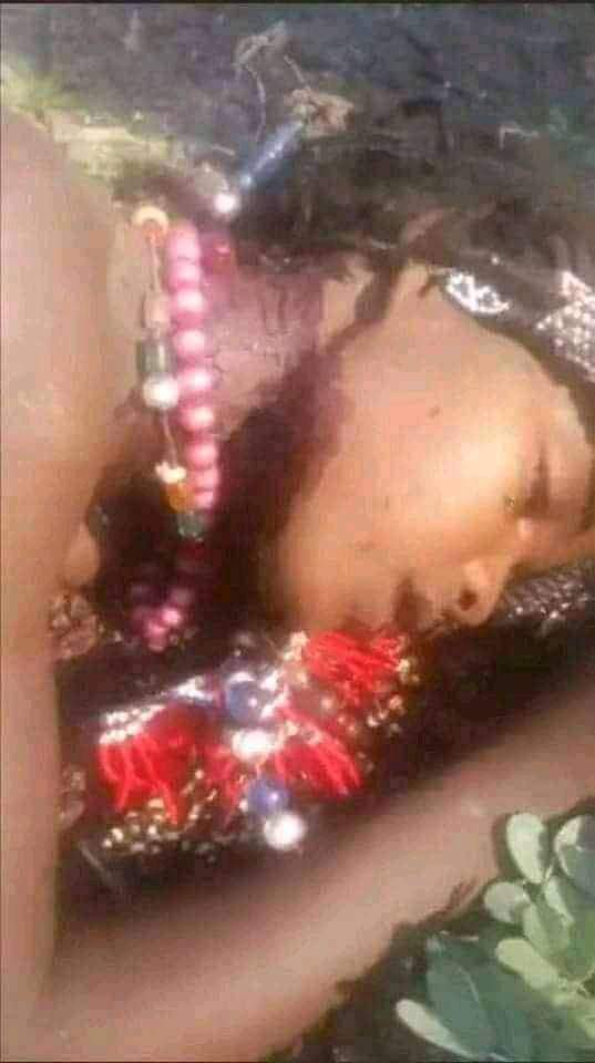 biedo_ali's tweet photo. #Afar_under_attack!
This is what the terrorist TPLF Junta has done to the Afar people by invading the Afar region. They are burning Afar children with heavy weapons. The people of the world must condemn this heinous act of genocide.
#Afar_children_lives_matter https://t.co/kc6dZaKDJl