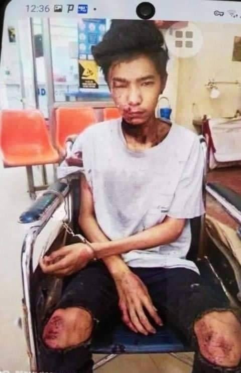 ydkr153's tweet photo. Pyae Sone Moe who was unjustly abducted by military troops on Feb 1 following a car explosion in Yangon, was now in critical condition. His house was sealed off and his brother was also issued a warrant. #2022Feb5Coup #WhatsHappeningInMyanmar https://t.co/lMeIVLnobY