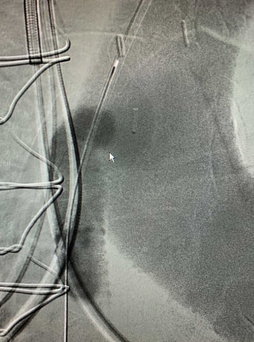 SandeepNathanMD tweet picture
