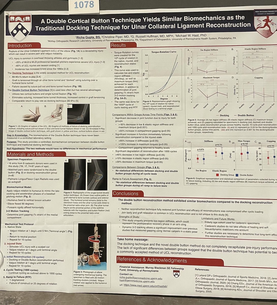 Please check out our poster (#1078) on the biomechanical efficacy of a novel UCL repair technique. 

Spoiler: it works!
#ORS2022