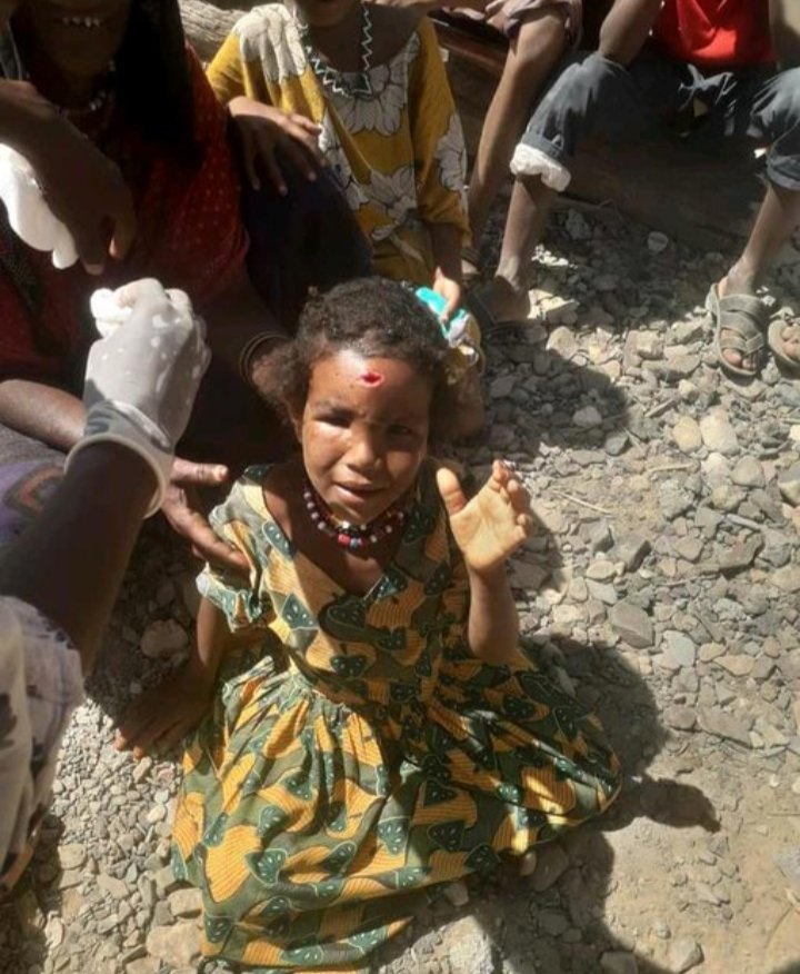 AM_HR_21's tweet photo. አገርም አለምም ትኩረት የነፈገዉ በህወሀት የከባድ መሳሪያ ጥቃት የአፋር ህጻናት እልቂት! https://t.co/qcizkVJJRD
