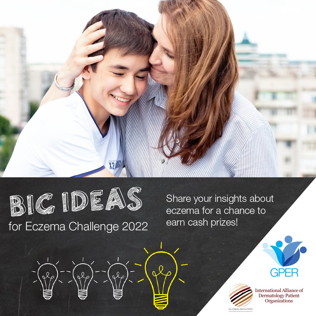 eczemaresearch's tweet photo. We invite #patients with #eczema and #caregivers to enter the #BigIdeasforEczemaChallenge. Help by being a #changemaker with your BIG IDEAS! ➡️Enter the contest at the link in our bio.
#patientengagement #patientcentered #patientsfirst #patientwisdom #eczemaawareness https://t.co/V0YkrgXmZv