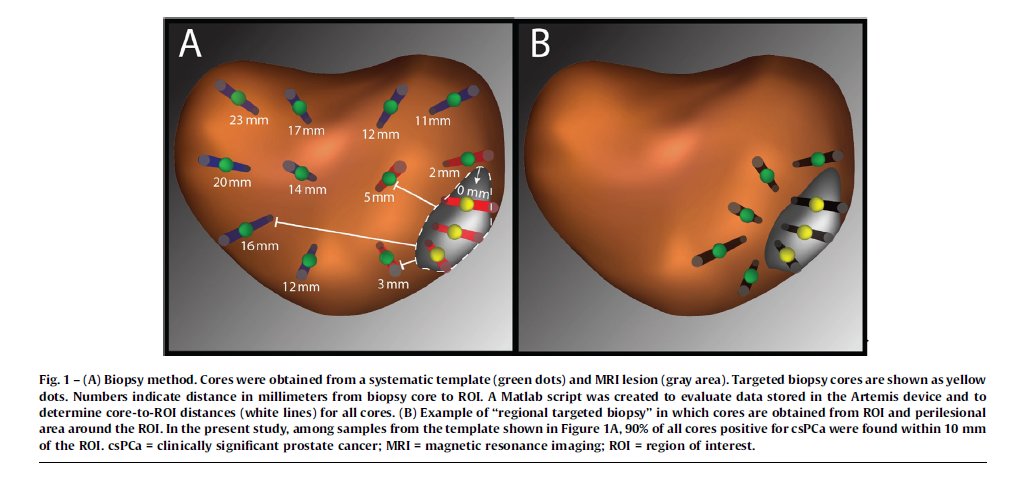Baris Turkbey MD tweet media