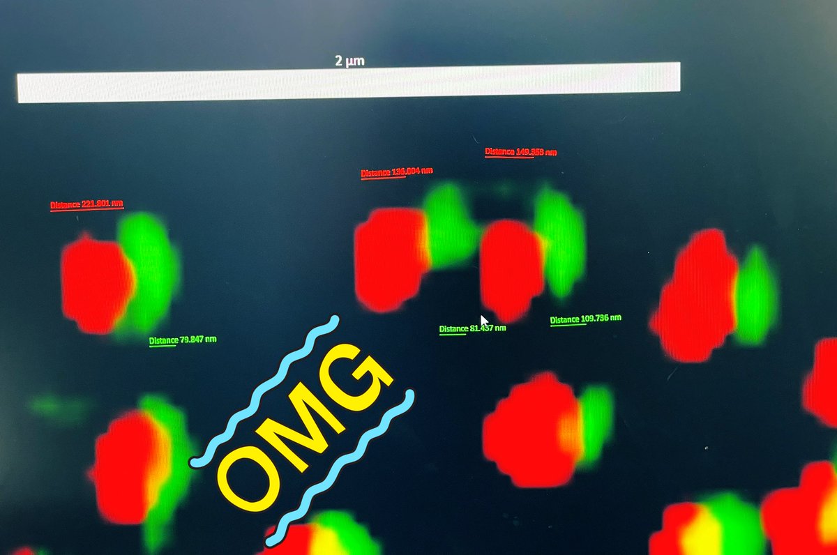 alunellab's tweet photo. #Cilia #cellpolarity #biology #lung

Just some proteins captured showing stunning polarisation within a cell of a whole mount airway. These are found at the basal bodies of motile cilia.  @zeiss_micro #lovewhatyoudo  #lsm880 #UCwhatIC 
@DavidTree https://t.co/Z4oavsuW9b