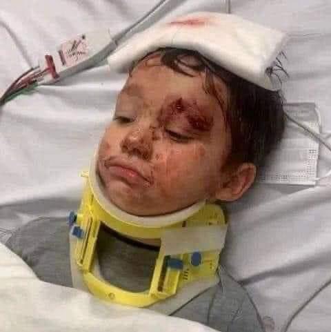 Alhamdulillah Allhamdullilaah Allhamdullilaah 
Rayan your mom and dad can see you right now😭☝🤲
May Allah recovery soon inshallah  
#rescuerayan #SaveRayan